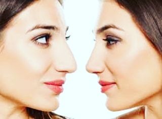 Antonio Calopresti-4