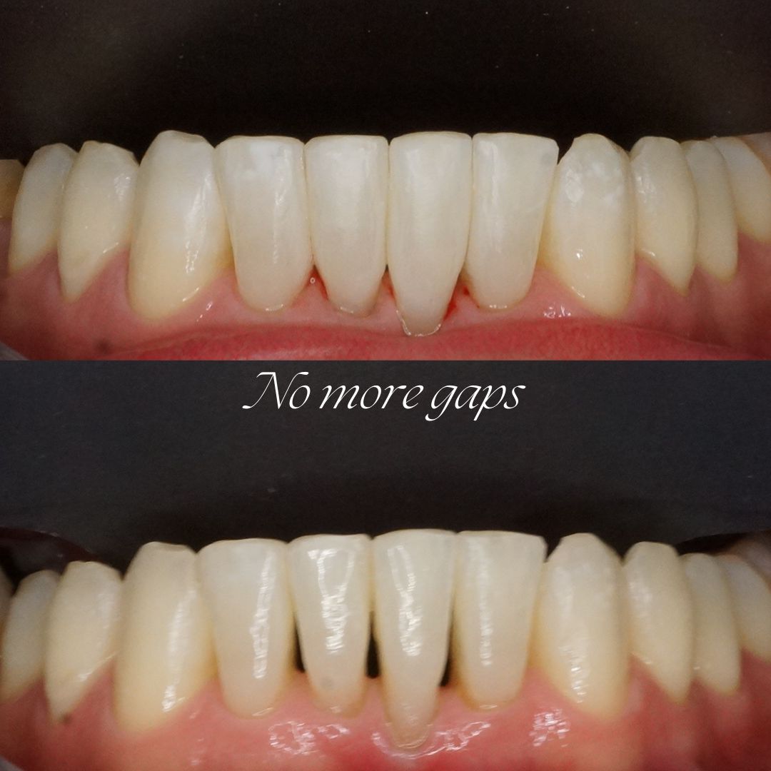 Raimonda Bogdanoviciute-29