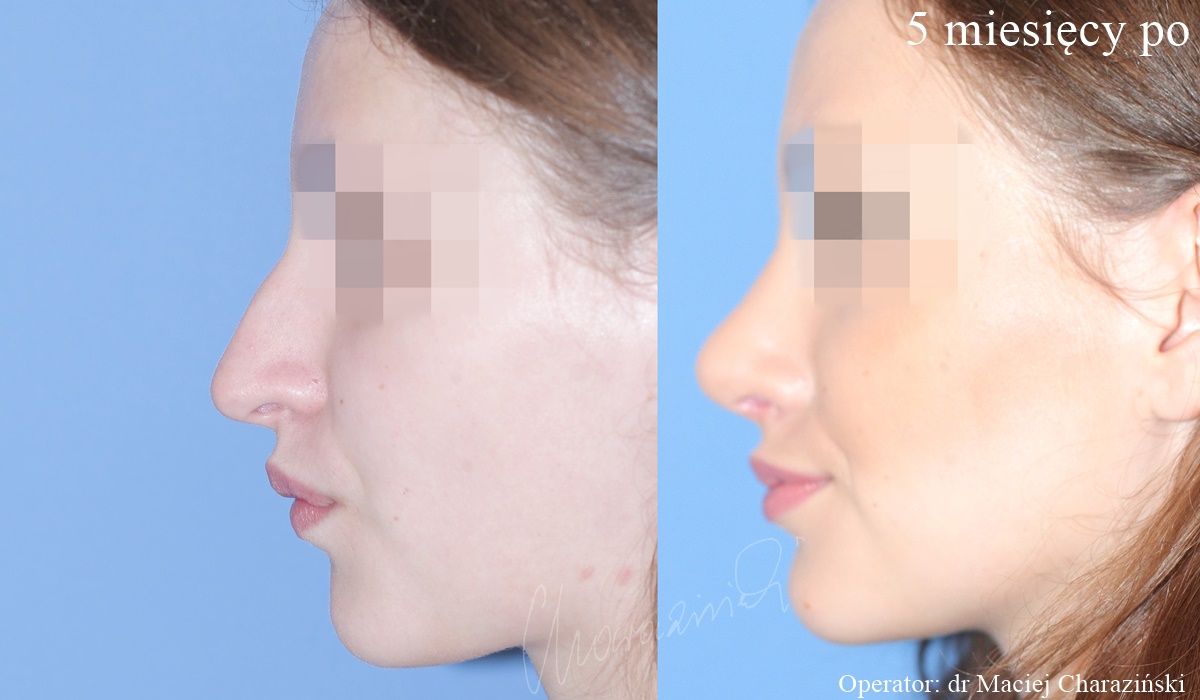 Maciej Charaziński-74