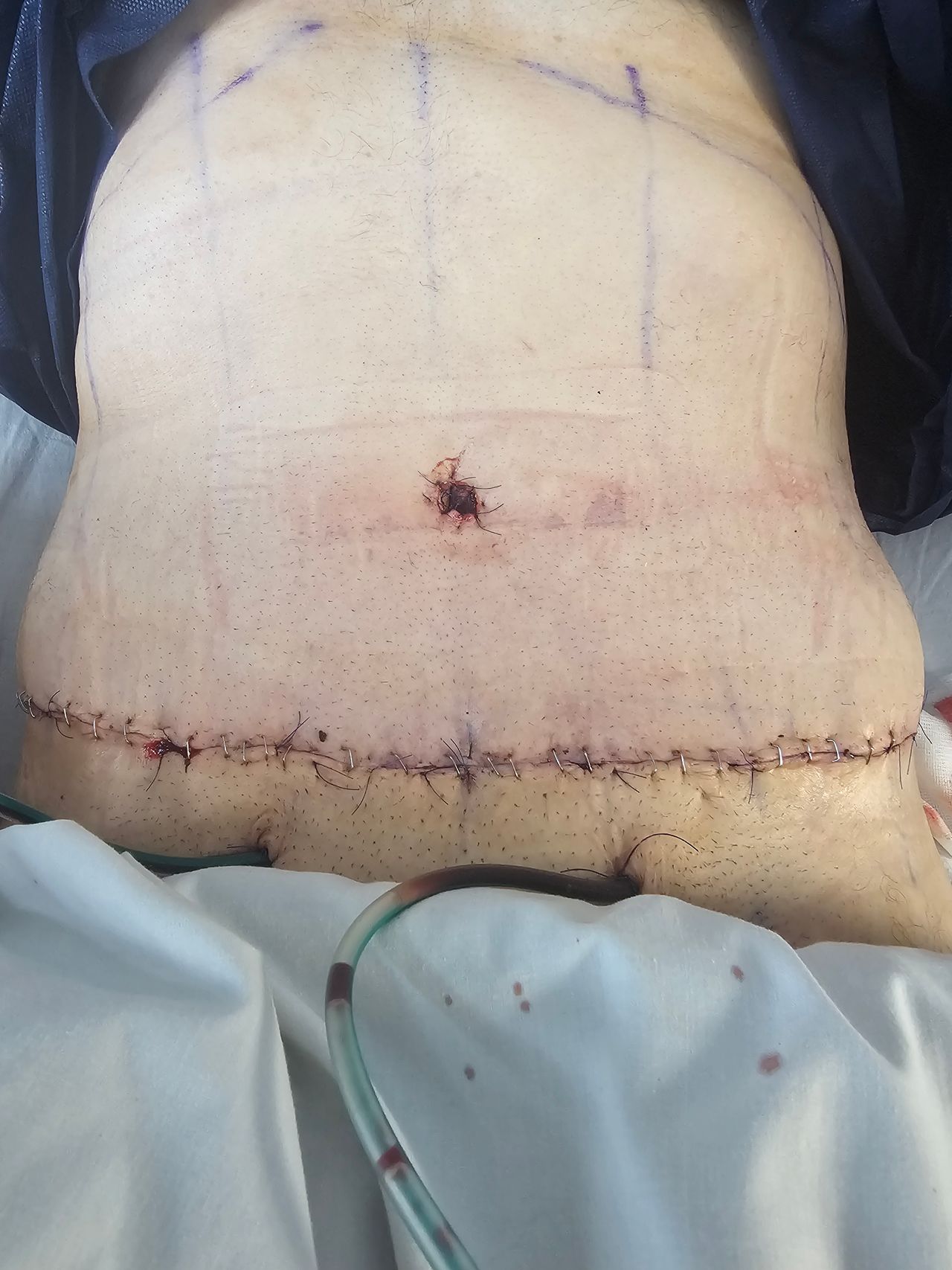 Bartłomiej  Staśkiewicz -8