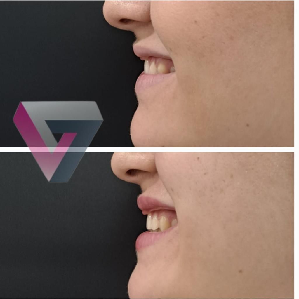 Victoria Trasmonte-48