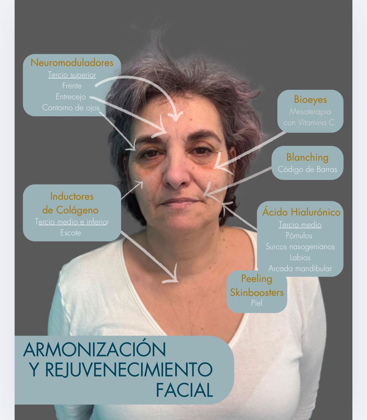 María De Los Ángeles Sotto Claude-5