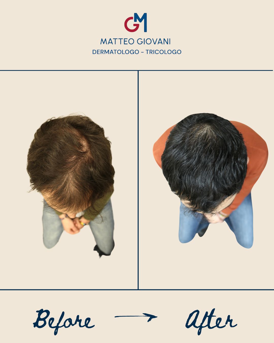 Matteo Giovani-12