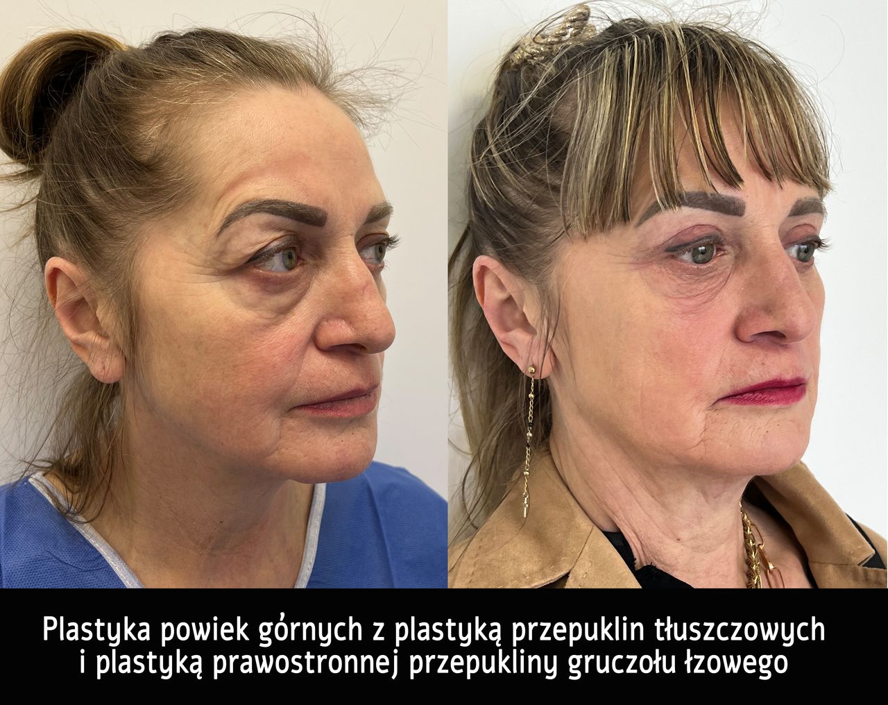 Mariusz Zagajewski-31