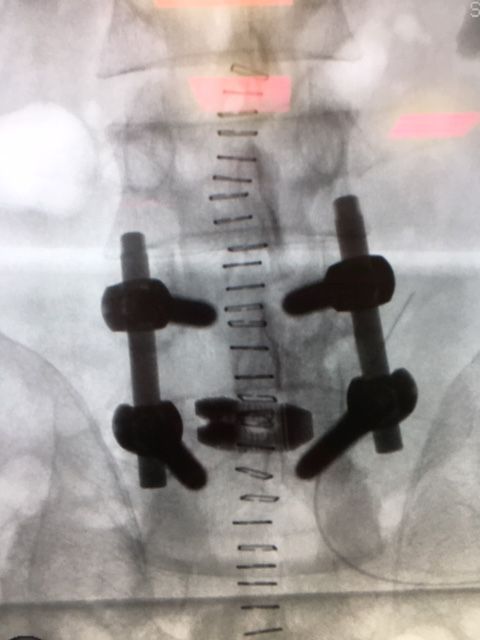 Massimo Brandolin-21