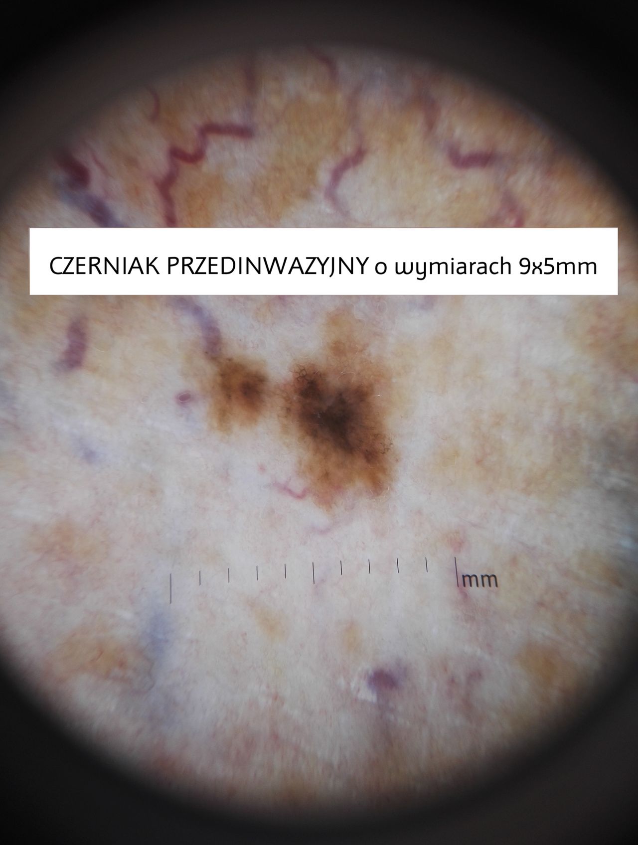 Paweł Pietkiewicz-2