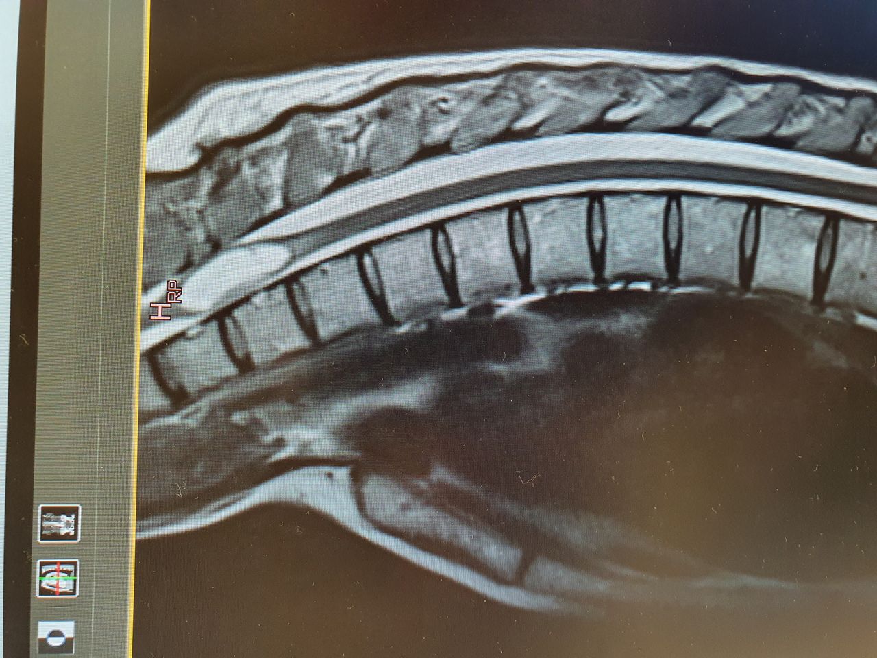 Luis De Miguel Pueyo-1