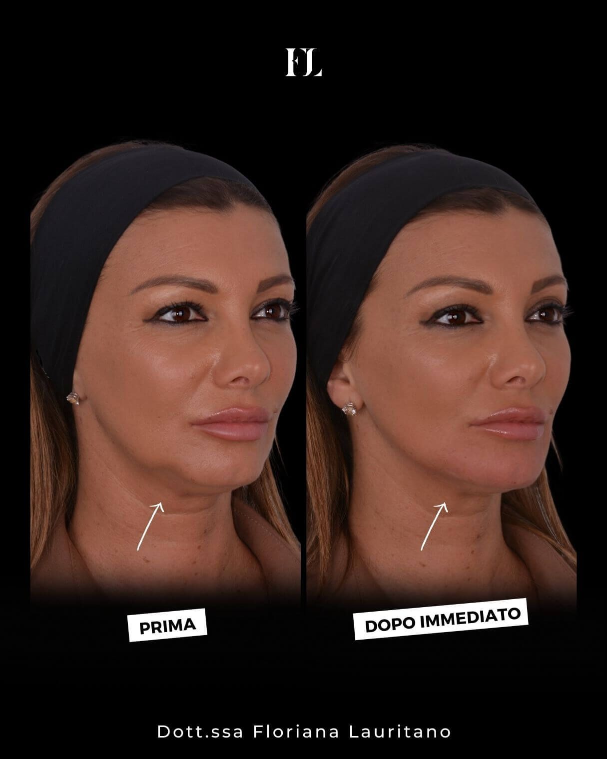 Floriana Lauritano-14