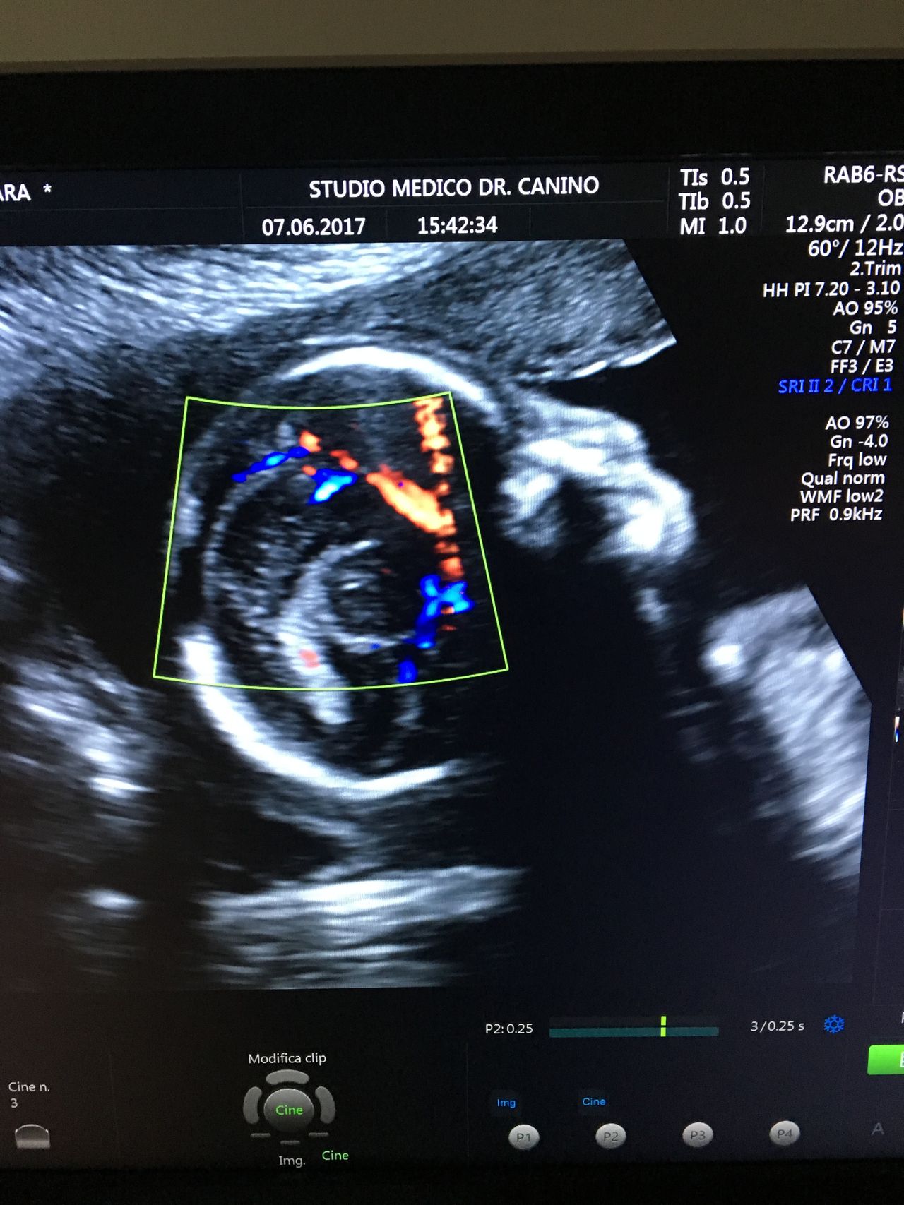 Francesco Antonio Bisogni-4