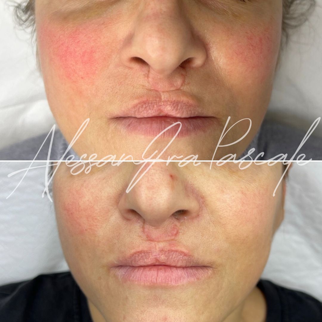 Alessandra Pascale-11