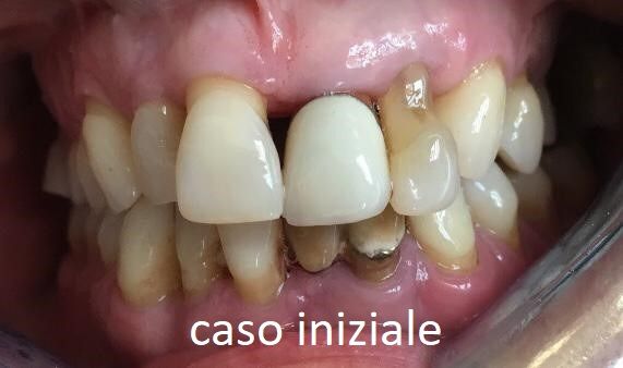 Michelina Borrelli-15