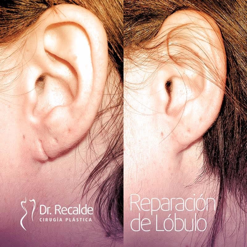 César Recalde Losada-2