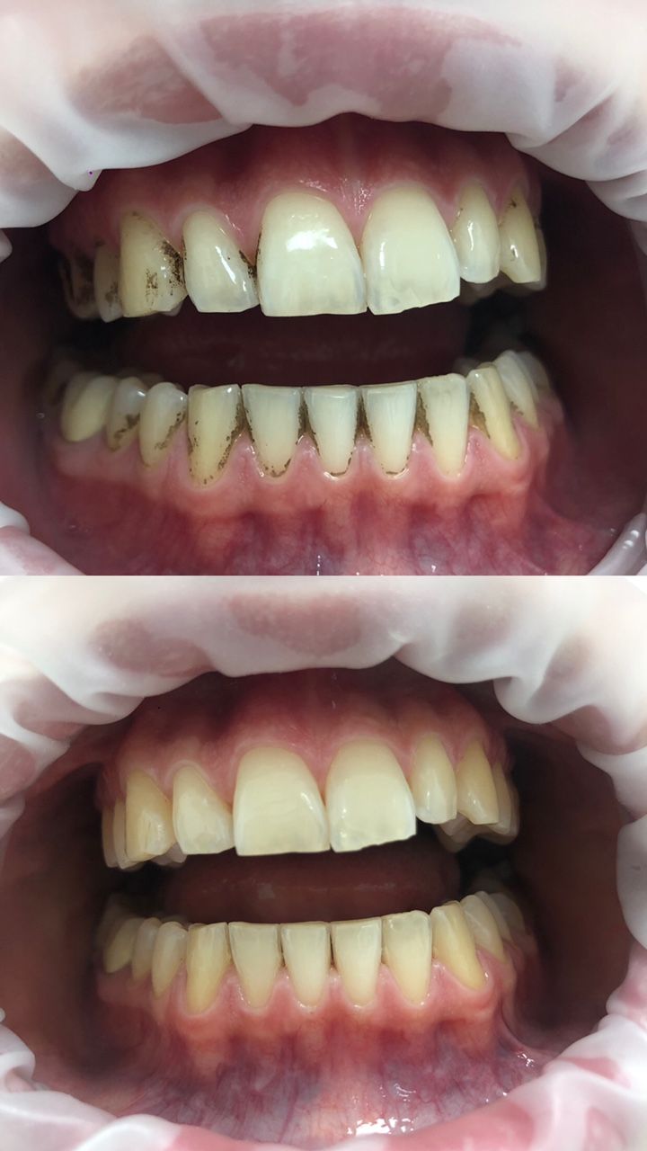 Oleksandra Chernykh-12