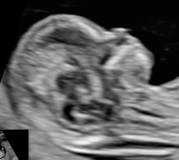 Joanna Krygowska-Zielińska-3