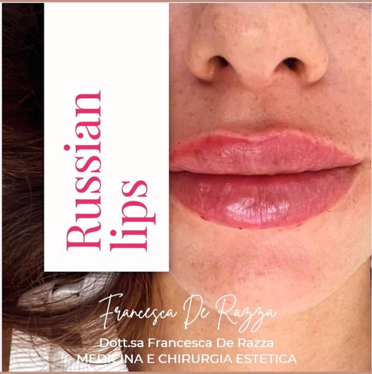 Francesca De Razza-68