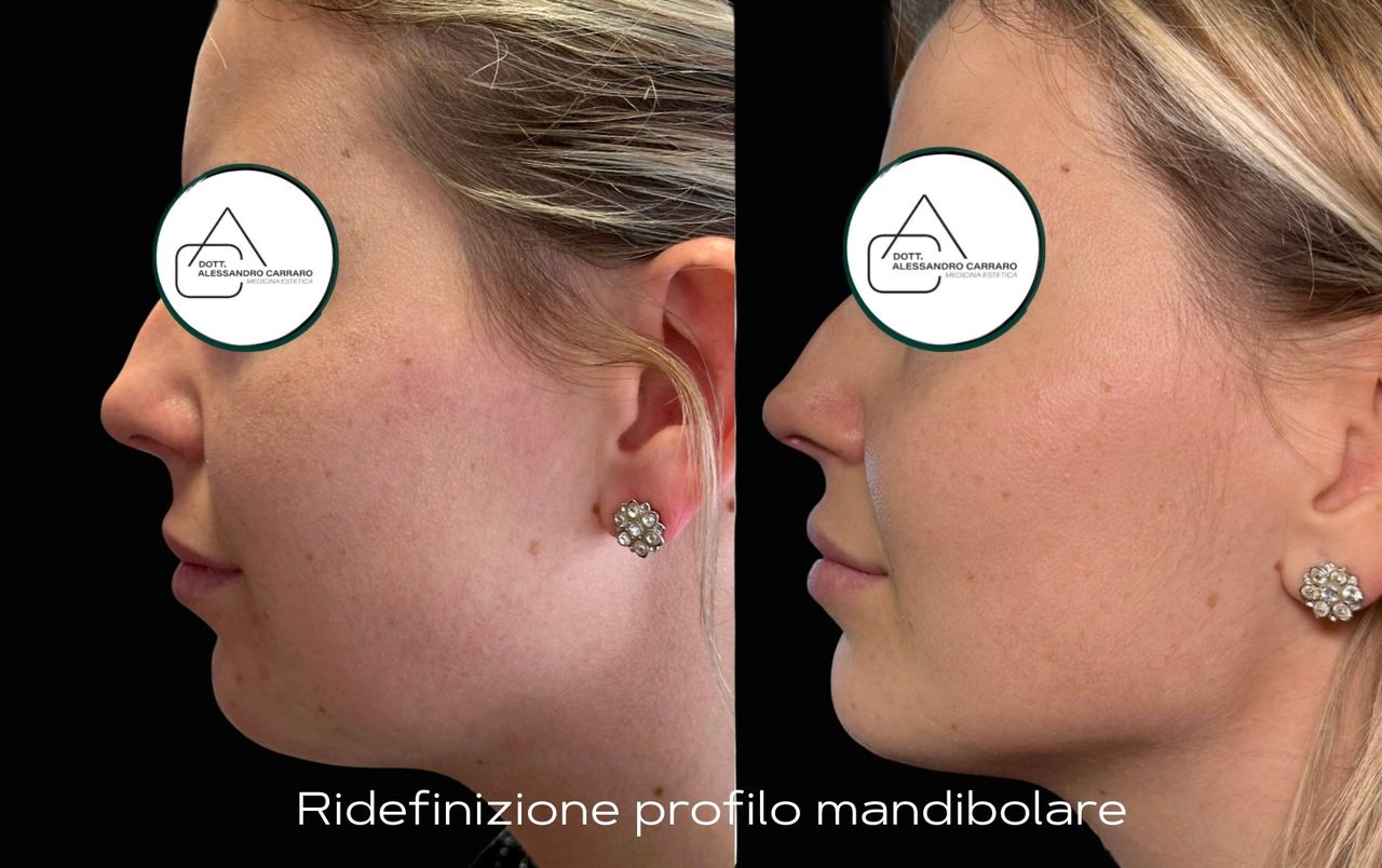 Alessandro Carraro-4