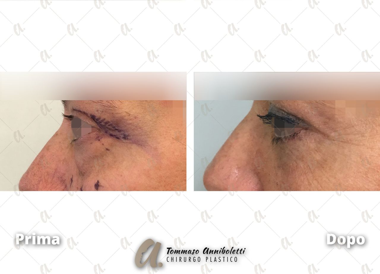 Tommaso Anniboletti-30