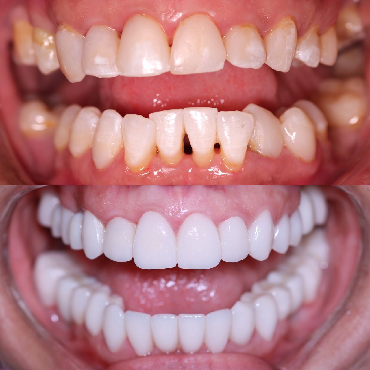 Antonia Aviles Lopez-53