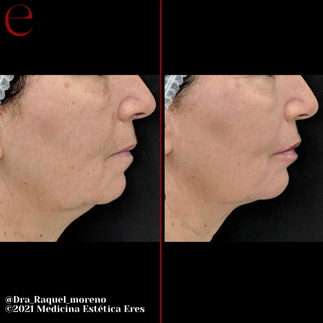 Raquel Moreno Pentinel-95