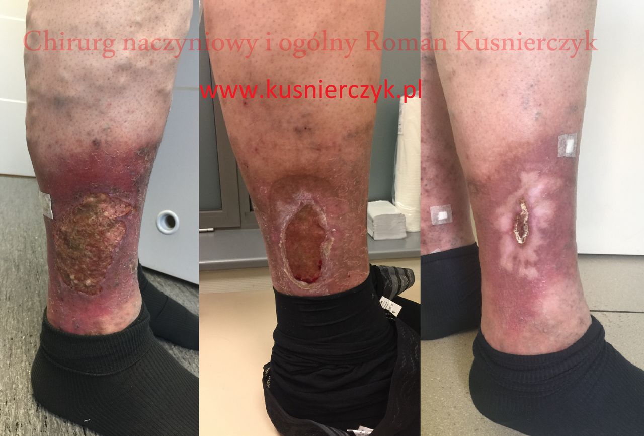 Roman Kuśnierczyk-5