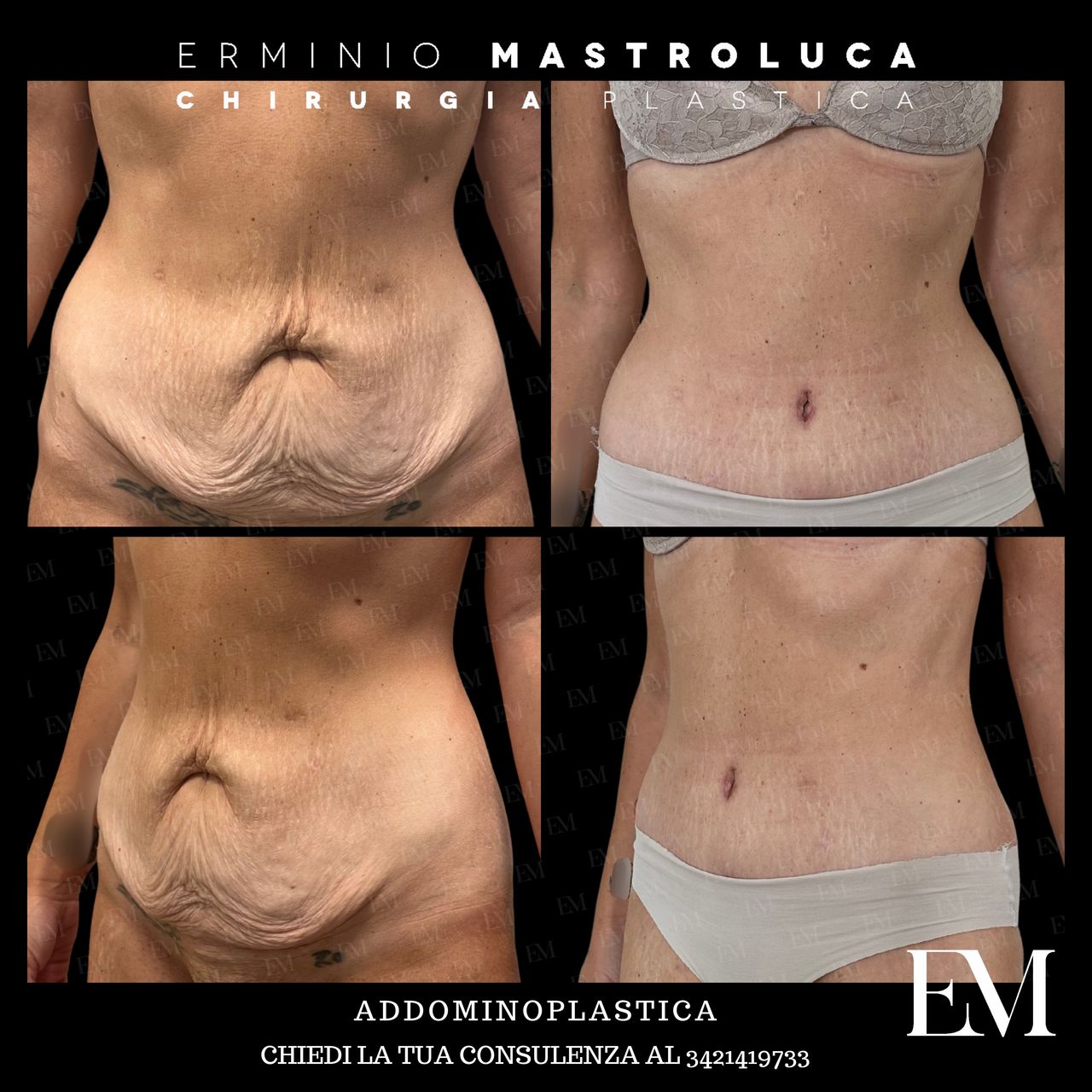 Erminio Mastroluca-22