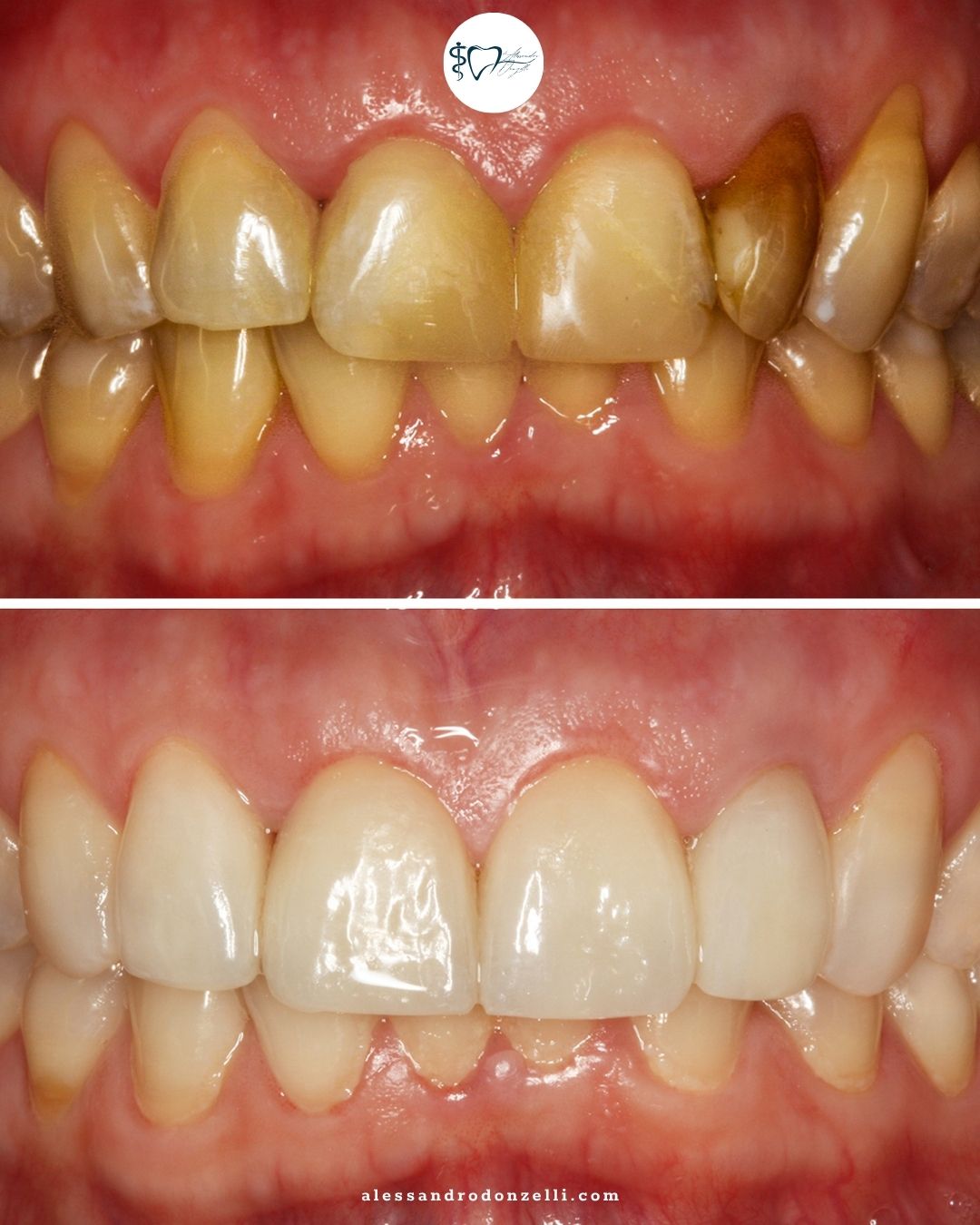 Alessandro Donzelli-0