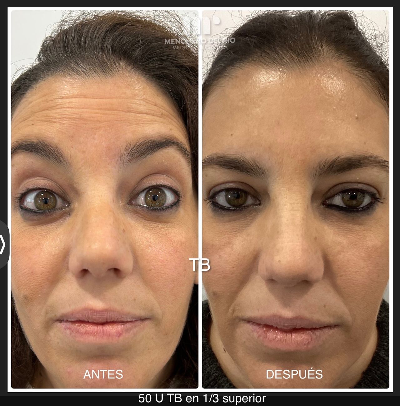 Arsenio Menchero Sánchez-11