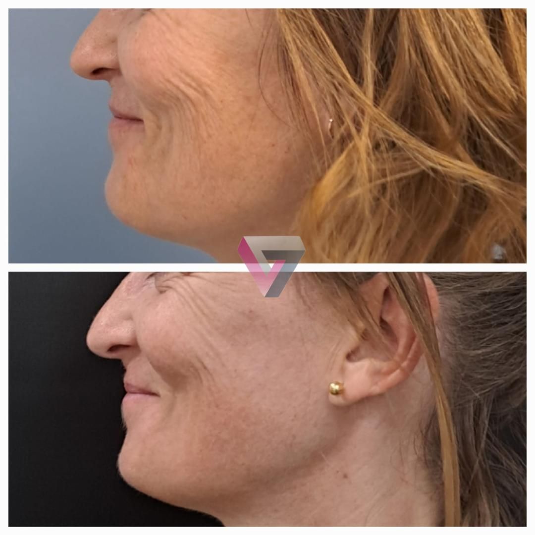 Victoria Trasmonte-88