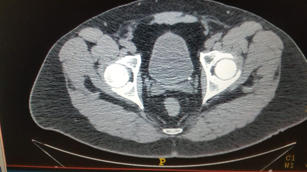 Josep Maria Auguet Martín-9