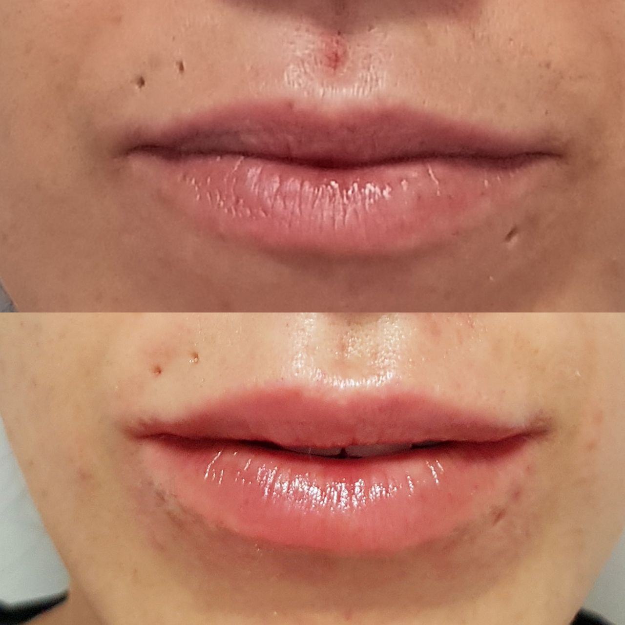 Rosalba Herrero Zerpa-320