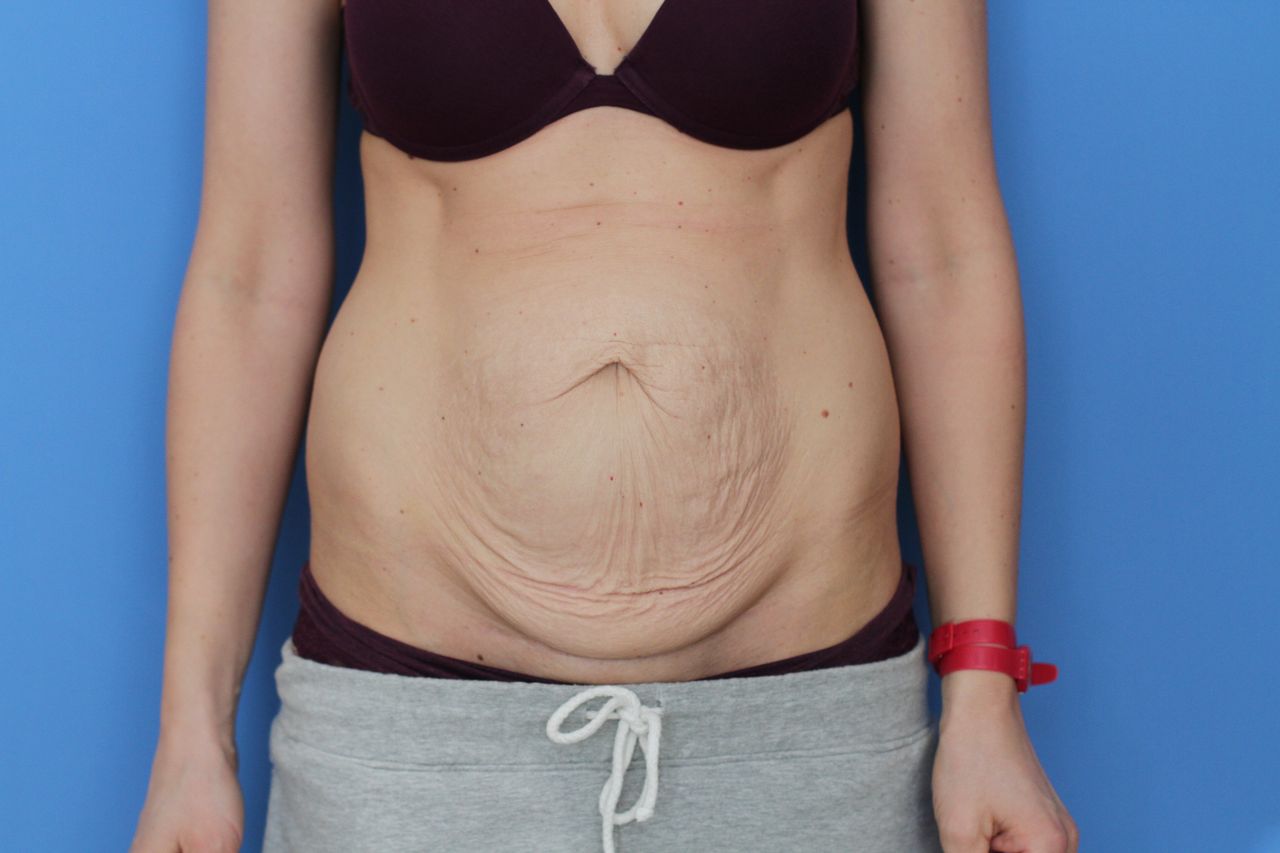 Maciej Charaziński-138