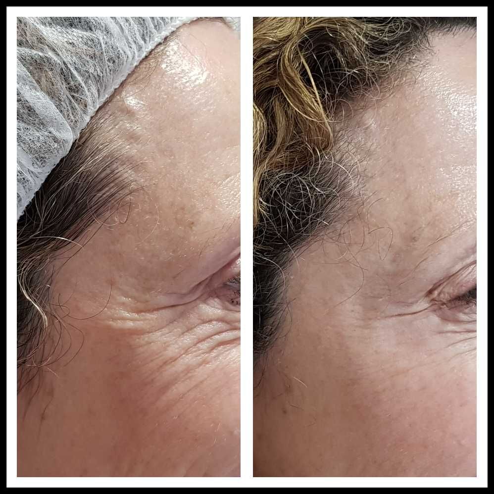 Rosalba Herrero Zerpa-342