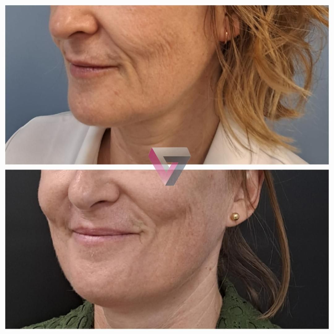 Victoria Trasmonte-87