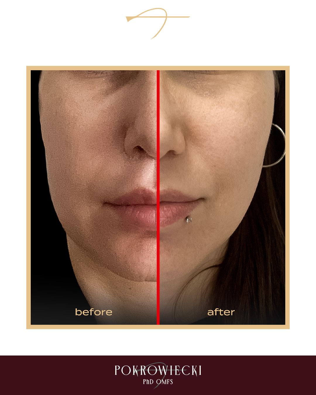 Rafał Pokrowiecki-23