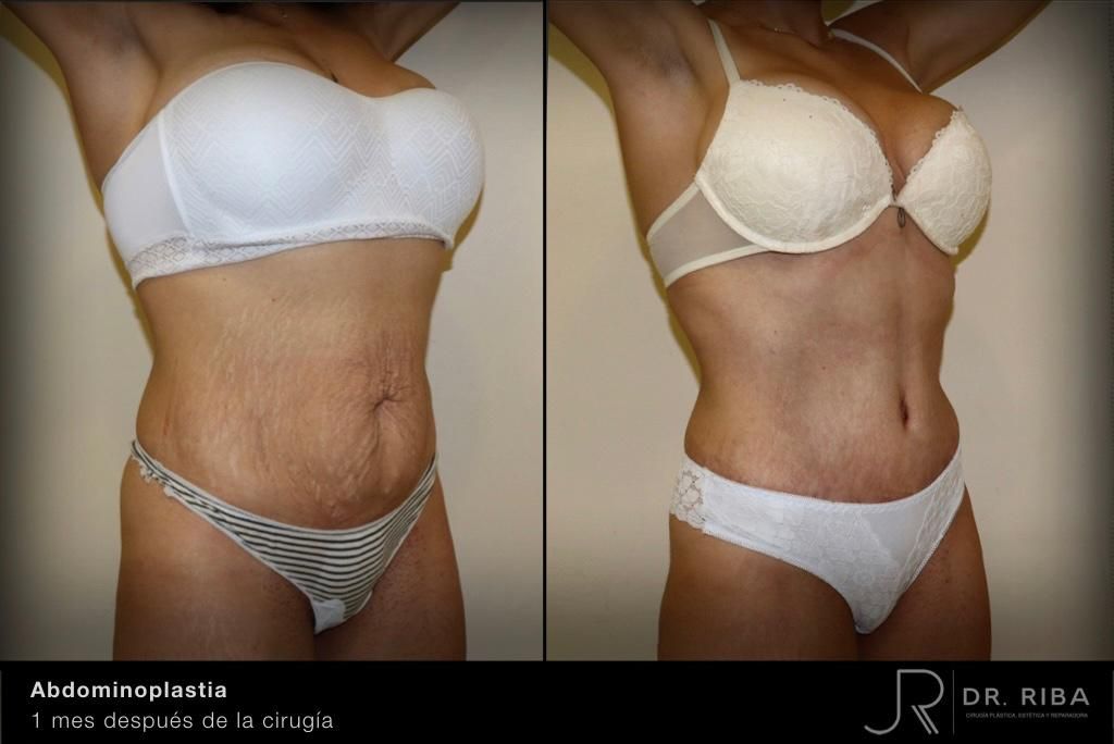 Jordi Riba Vilchez-24