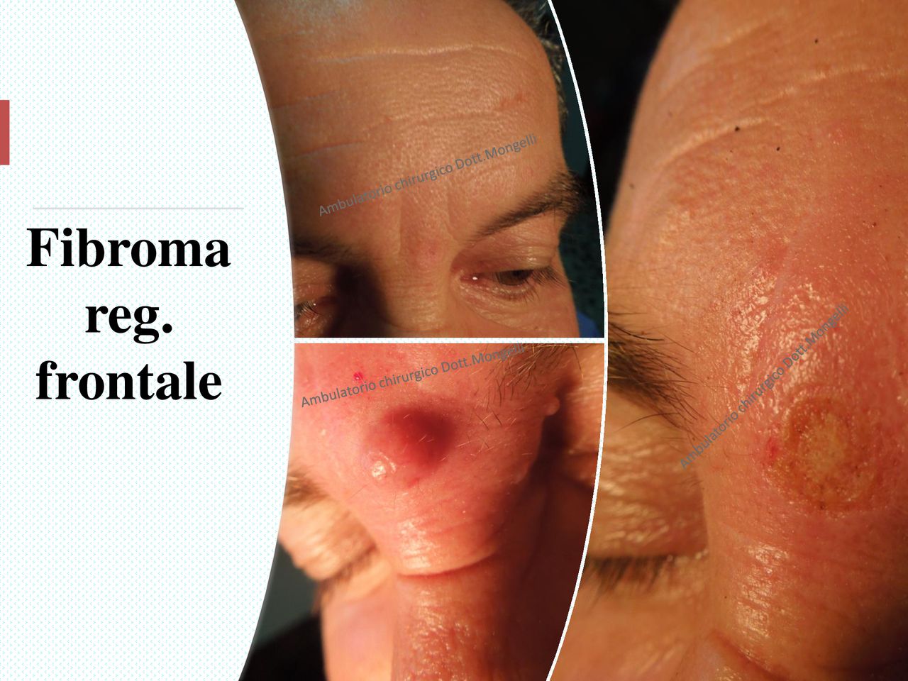 Matteo Antonio Mongelli-18