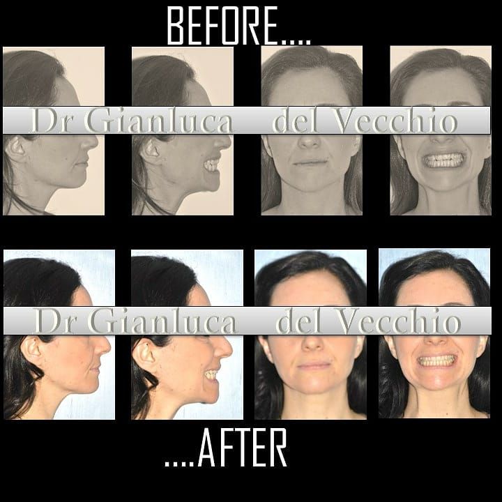 Gianluca Del Vecchio-57