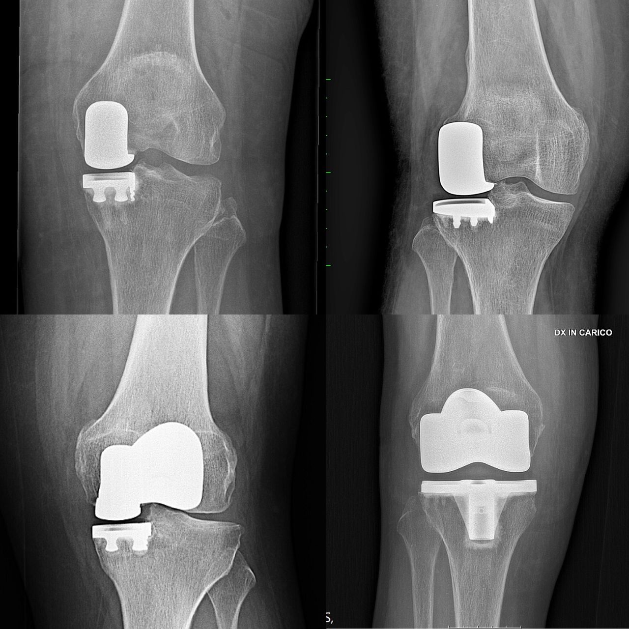 Marco Bargagliotti-0