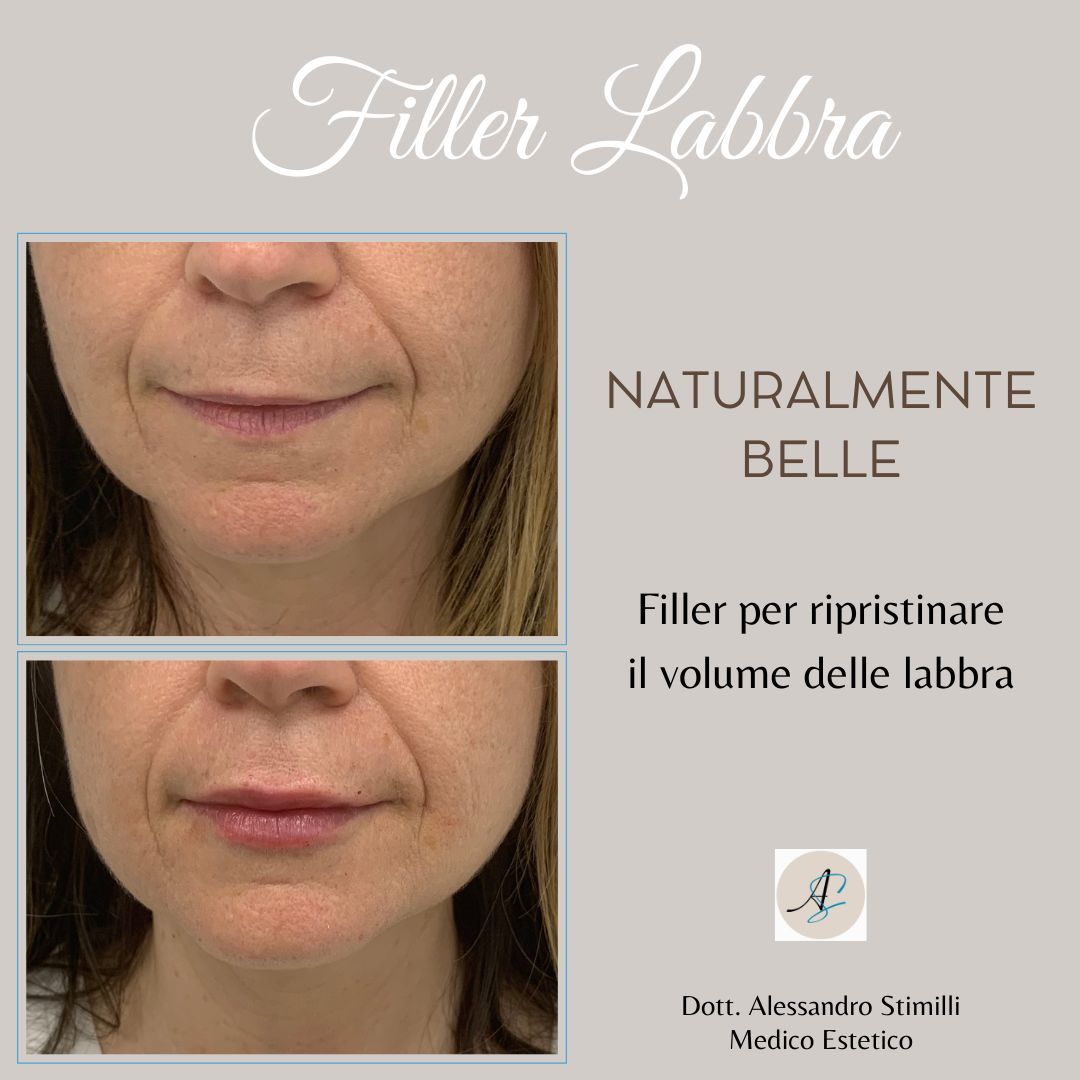 Alessandro Stimilli-21