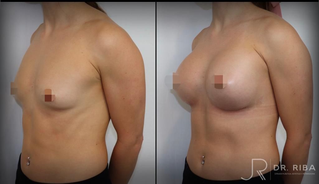 Jordi Riba Vilchez-35