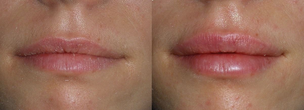 Pasquale Di Molfetta-4