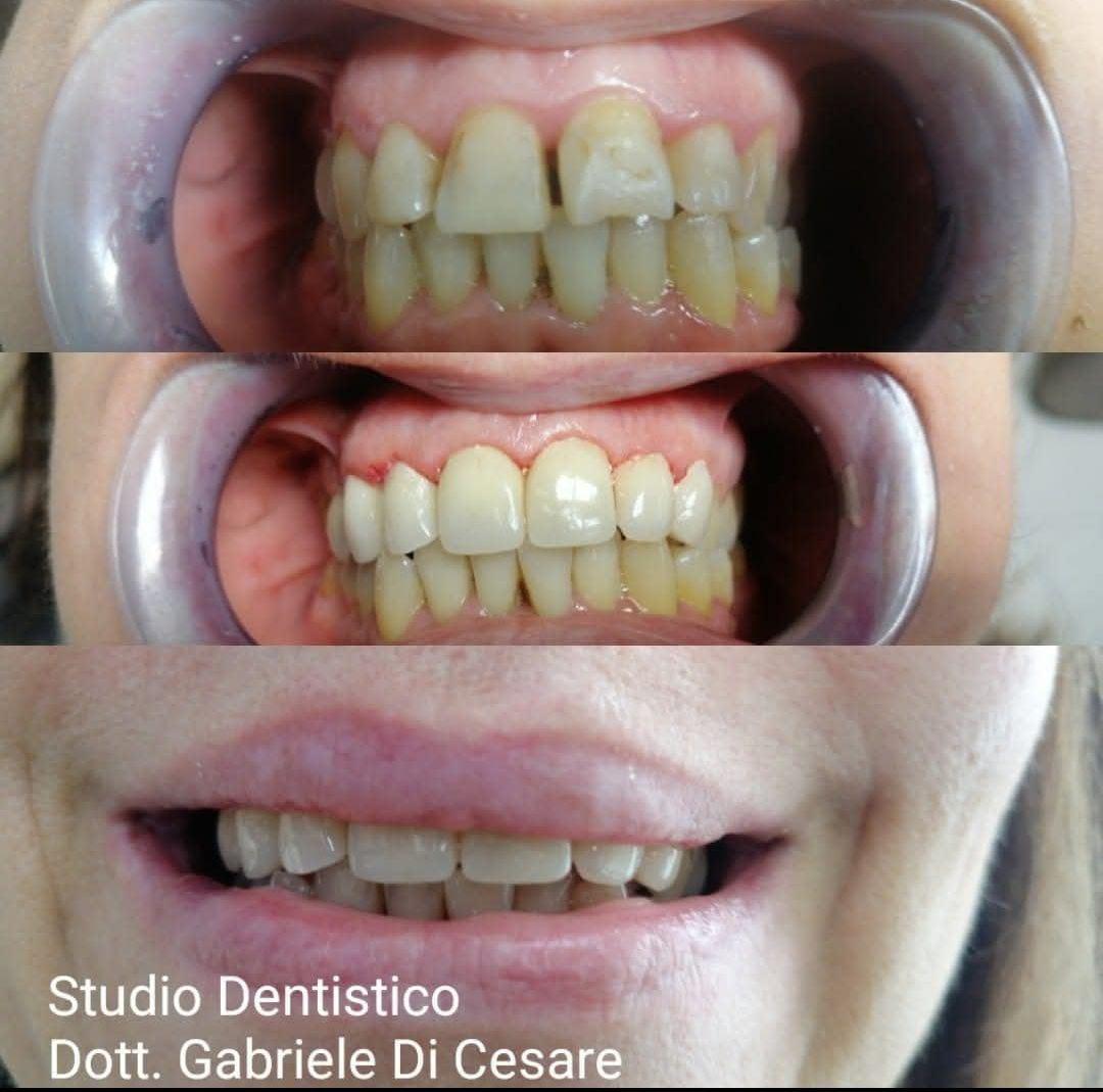 Gabriele Di Cesare-0