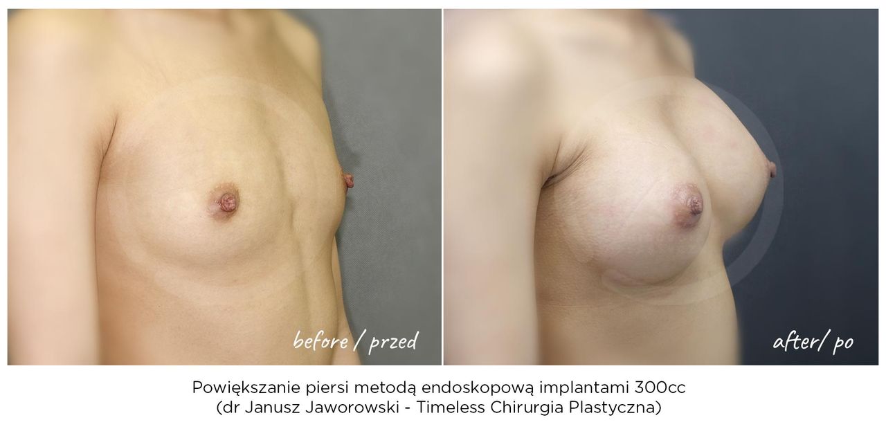 Janusz Jaworowski-155