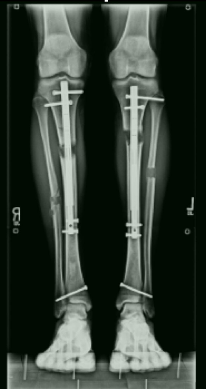 Jarosław Michał Deszczyński-4