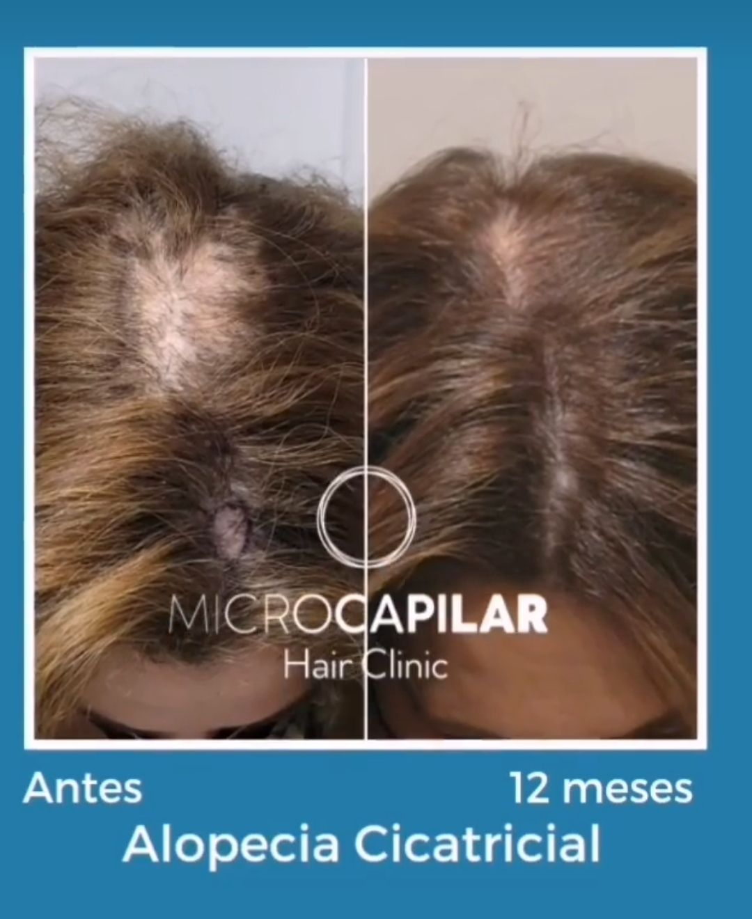 Uraima Argotty Rodríguez-5