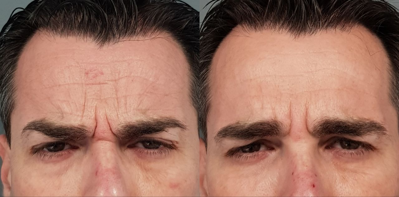 Rosalba Herrero Zerpa-152