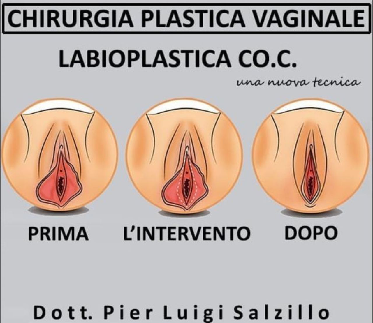 Pier Luigi Salzillo-6