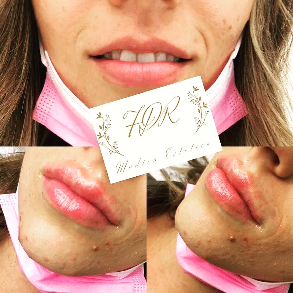 Francesca De Razza-25