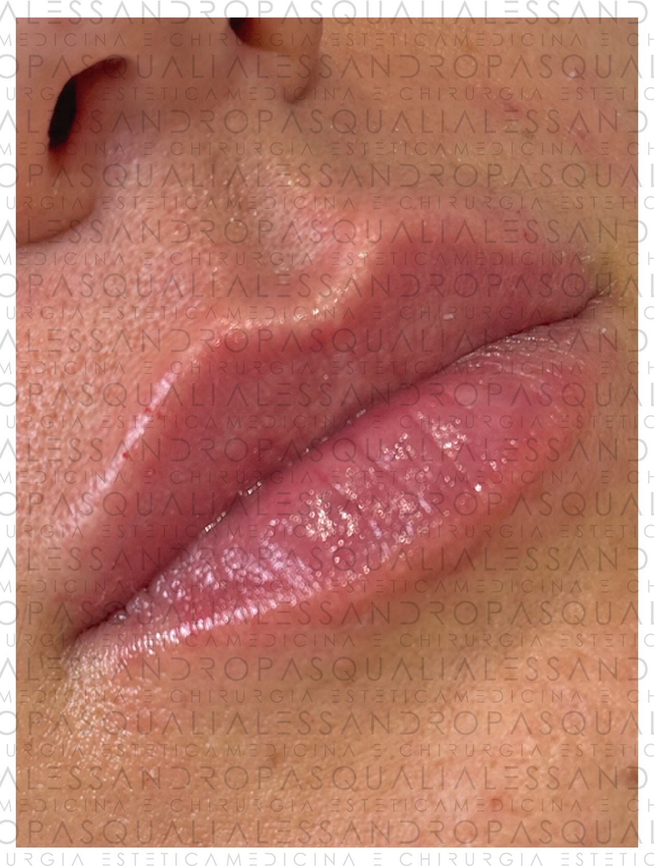 Alessandro Pasquali-0