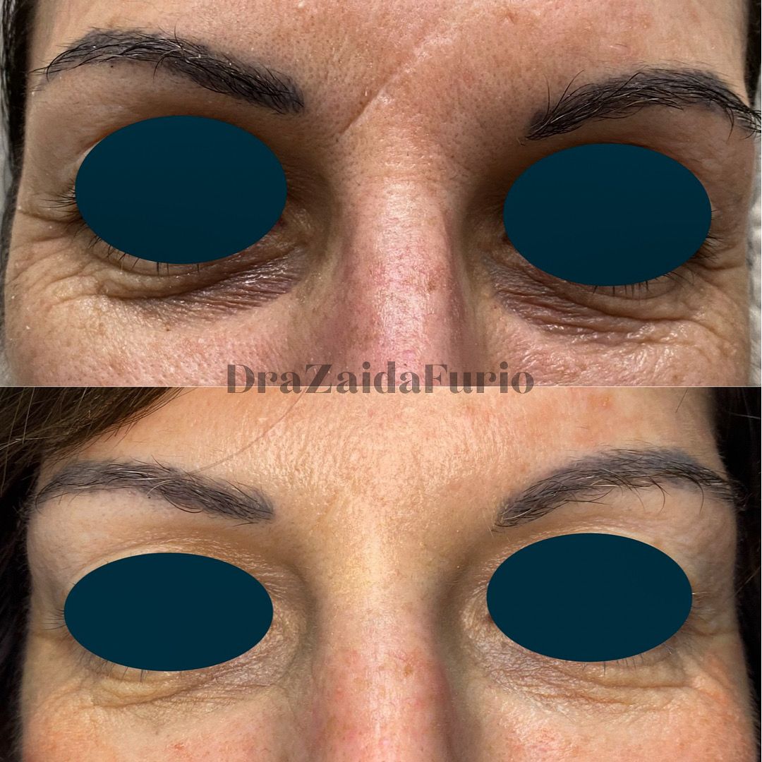 Zaida Furió Bernardo-3